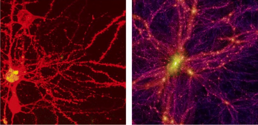 Brain_Universe