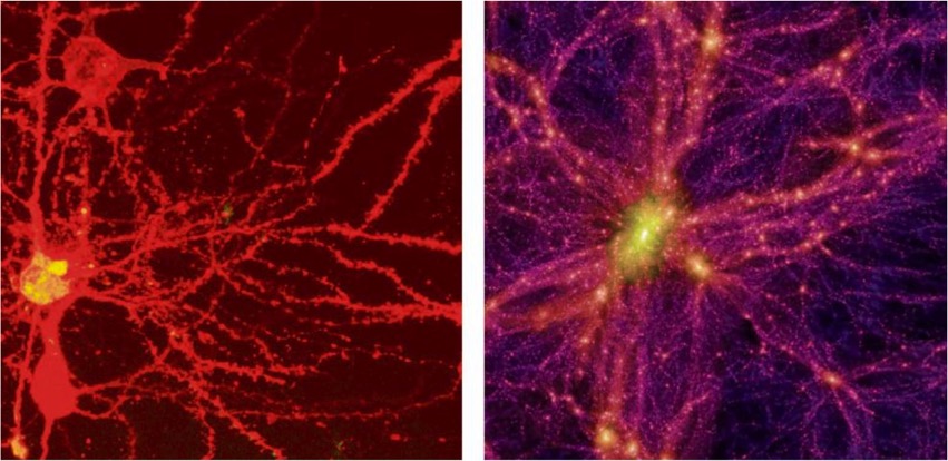Brain_Universe